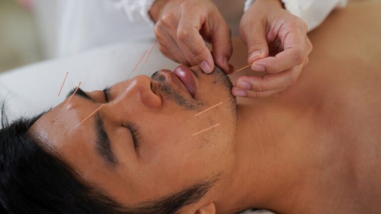 Facial-acupuncture-in-Philadelphia