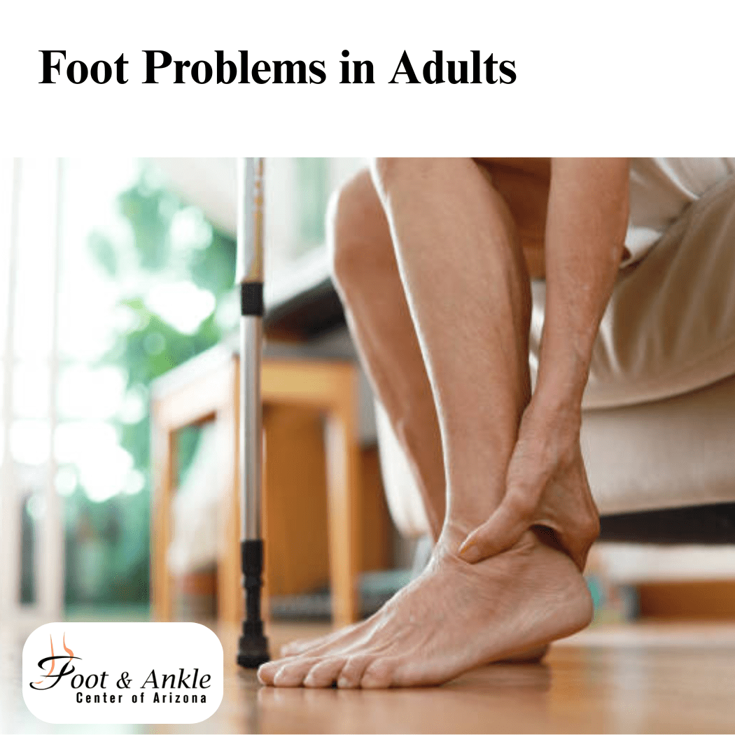 Common Foot Problems in Adults – Get Expert Tips
