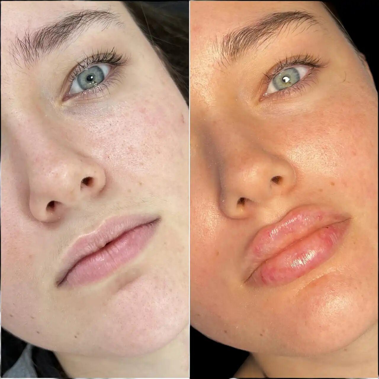 Best Plastic Surgeon in dubai for Full Facial Contouring with Fillers