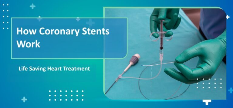 How-Coronary-stents-Works