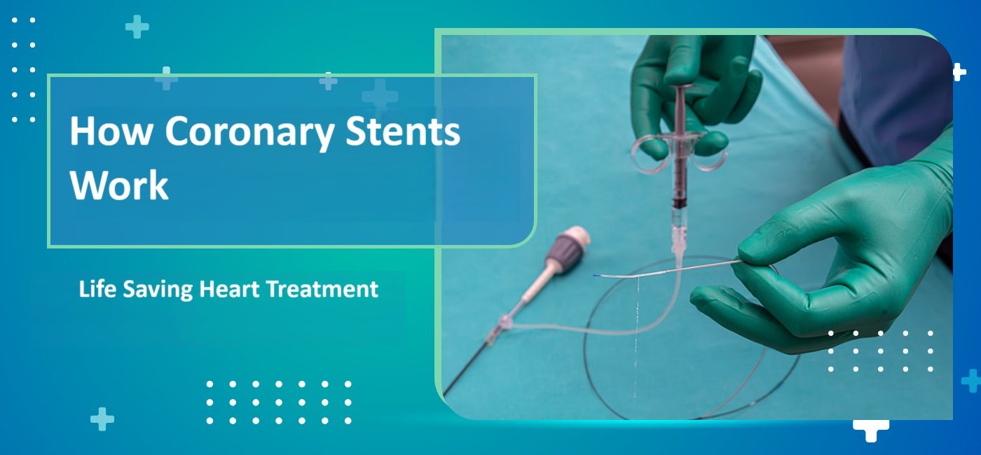 How Coronary Stents Work : Life-Saving Heart Treatment