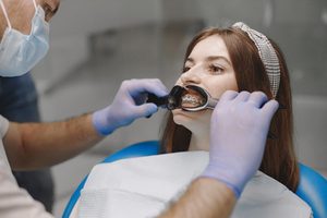 dental-cleanings-1
