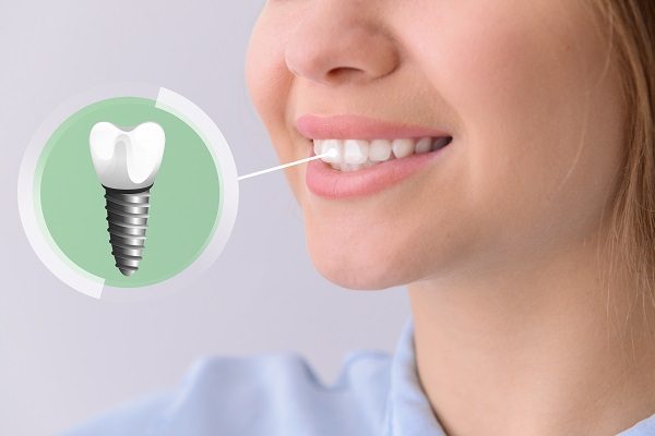 Top 7 Reasons to Choose Pleasant Dental – Your Trusted Dental Clinic in Bedford