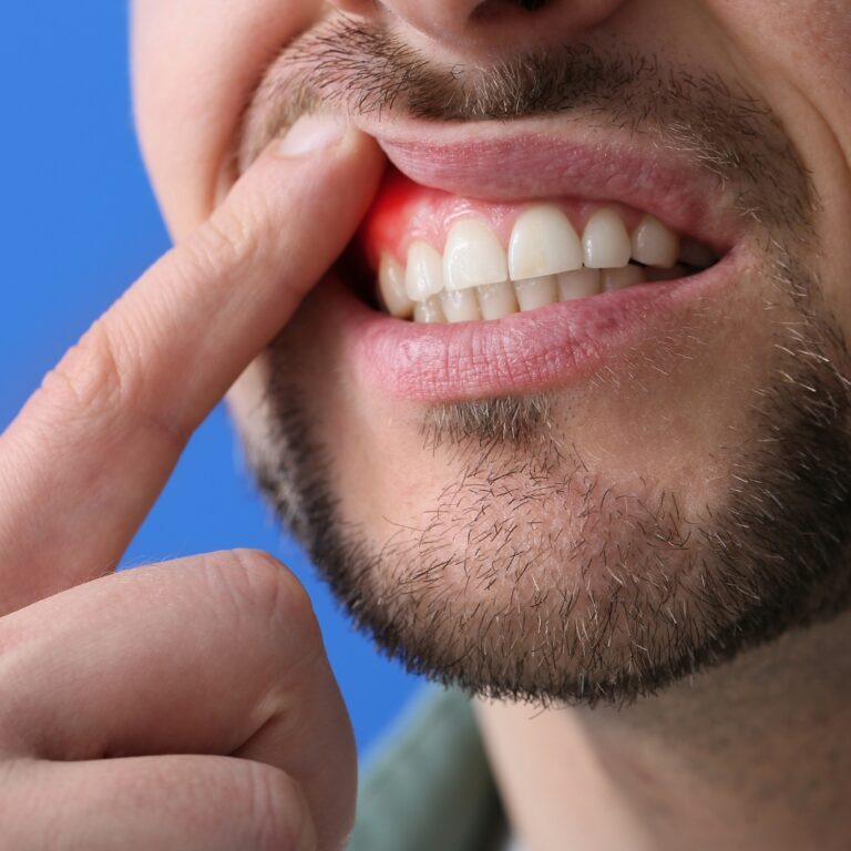 hole-in-gum-1
