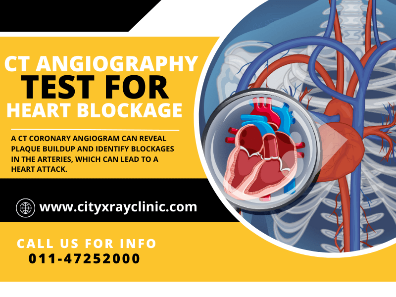 CT Coronary Angiography Price: What You Should Know Before Booking Your Test