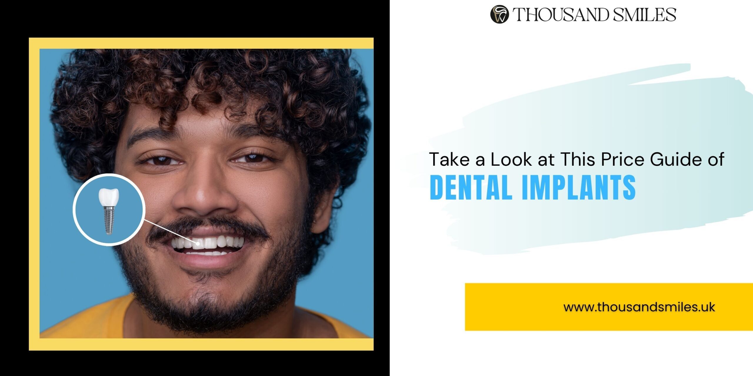 Take a Look at This Price Guide of Dental Implants in 2025