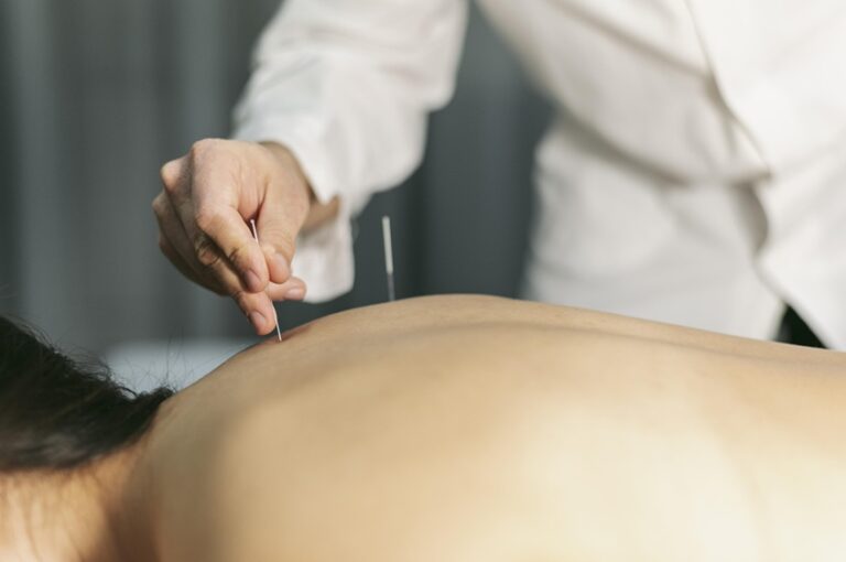 Acupuncture-Clinics-in-Vancouver
