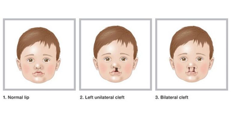 craniofacial1