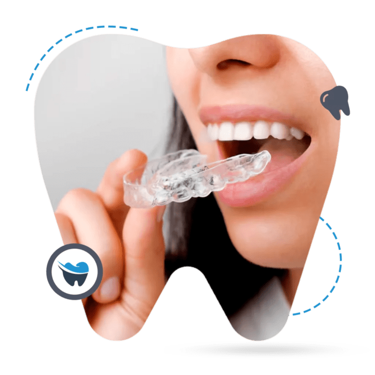custom-mouthguards-in-Perth